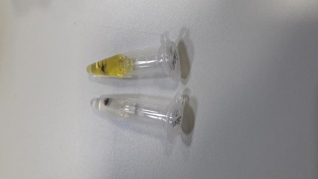 Na foto, a mudança de coloração que atesta a presenta de anticorpos do coronavírus no corpo. Fotos: Divulgação/Secom-UFPR